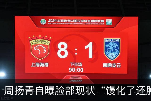 周扬青自曝脸部现状“馒化了还肿了”，此前曾多次自曝整容经历，呼吁大家不要轻易整容